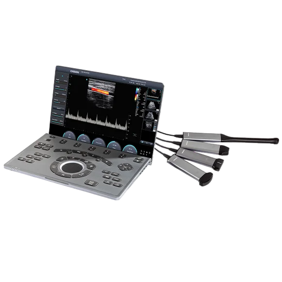 Chison SonoAir 30